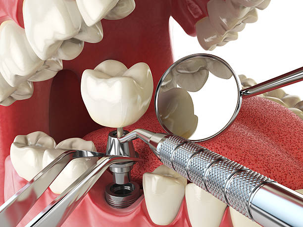 Best Emergency Treatment for Oral Infections in Rockton, IL